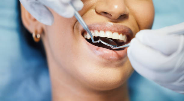Best Dental Abscess Treatment in Del Rio, CA
