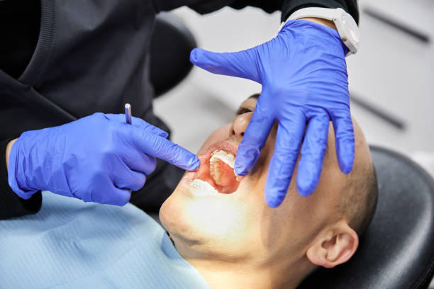 Best Emergency Treatment for Oral Infections in Del Rio, CA